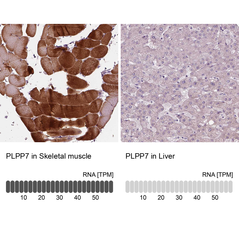 Anti-PLPP7 Antibody