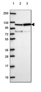 Lane 1: Marker [kDa] 250, 130, 95, 72, 55, 36, 28, 17, 10_br/_Lane 2: Human cell line RT-4_br/_Lane 3: Human cell line U-251 MG