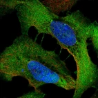 Immunofluorescent staining of human cell line U-2 OS shows localization to plasma membrane & cell junctions.