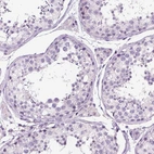 Immunohistochemical staining of human testis shows no positivity in cells in seminiferous ducts as expected.