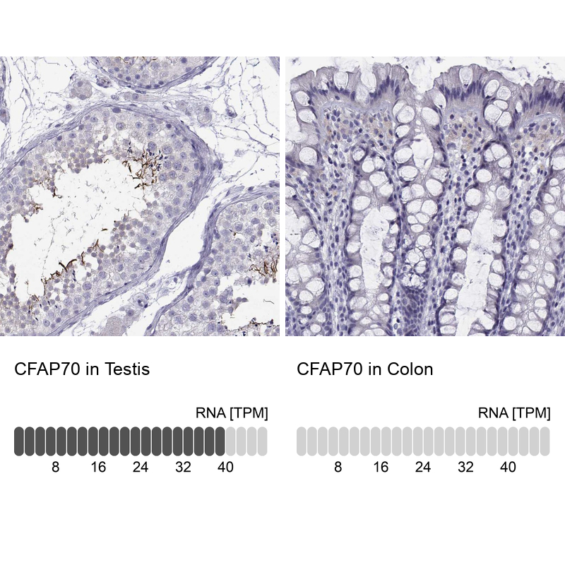 Anti-CFAP70 Antibody