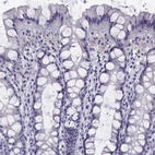 Immunohistochemical staining of human colon shows low expression as expected.