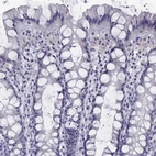 Immunohistochemical staining of human colon shows low expression as expected.