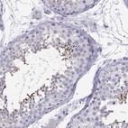 Immunohistochemical staining of human testis shows high expression.