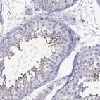 Immunohistochemical staining of human testis shows high expression.