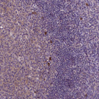 Immunohistochemical staining of human tonsil shows strong cytoplasmic positivity in germinal center cells and non-germinal cells.
