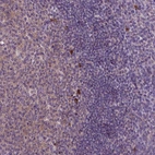 Immunohistochemical staining of human tonsil shows strong cytoplasmic positivity in germinal center cells and non-germinal cells.