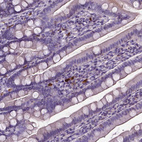 Immunohistochemical staining of human duodenum shows strong cytoplasmic positivity in lymphoid cells.