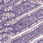 Immunohistochemical staining of human duodenum shows strong cytoplasmic positivity in lymphoid cells.