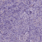 Immunohistochemical staining of human pancreas shows no positivity in exocrine glandular cells as expected.