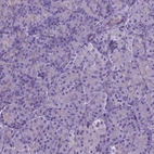 Immunohistochemical staining of human pancreas shows no positivity in exocrine glandular cells as expected.