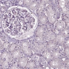 Immunohistochemical staining of human kidney shows no positivity in cells in tubules and cells in glomeruli as expected.