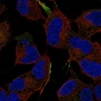 Anti-MAPK8IP1 Antibody