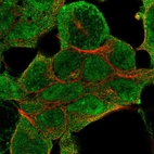 Anti-NSD1 Antibody