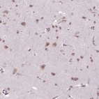 Immunohistochemical staining of human cerebral cortex shows high expression.
