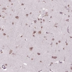 Immunohistochemical staining of human cerebral cortex shows high expression.