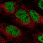 Immunofluorescent staining of human cell line CACO-2 shows localization to nucleoplasm.