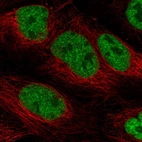 Immunofluorescent staining of human cell line CACO-2 shows localization to nucleoplasm.
