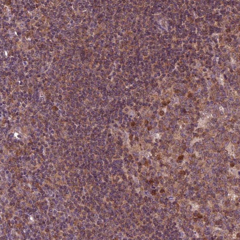 Anti-MDP1 Antibody