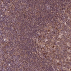 Anti-MDP1 Antibody