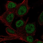 Immunofluorescent staining of human cell line SK-MEL-30 shows localization to nucleoplasm.