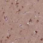 Anti-ST6GALNAC5 Antibody