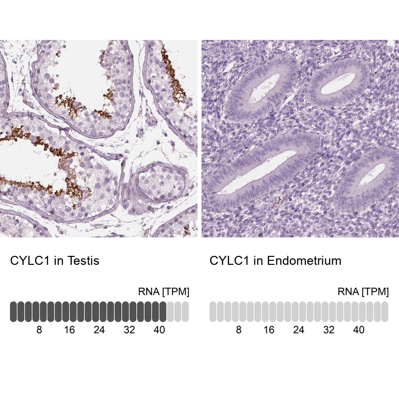 Anti-CYLC1 Antibody