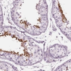 Immunohistochemical staining of human testis shows high expression.