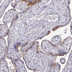 Immunohistochemical staining of human placenta shows moderate membranous positivity in trophoblastic cells.