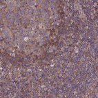 Anti-ARAP1 Antibody
