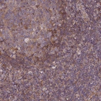 Anti-ARAP1 Antibody