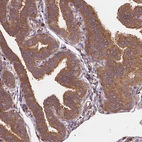 Immunohistochemical staining of human fallopian tube shows moderate membranous and cytoplasmic positivity in glandular cells.