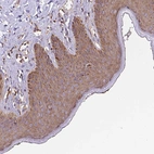 Immunohistochemical staining of human skin shows moderate cytoplasmic positivity in squamous epithelial cells.