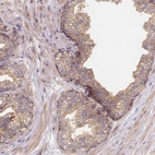 Immunohistochemical staining of human prostate shows moderate membranous and cytoplasmic positivity in glandular cells.