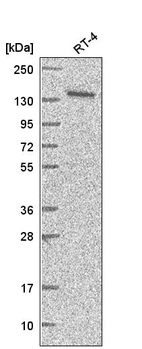 Western blot analysis in human cell line RT-4.