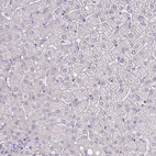 Immunohistochemical staining of human liver shows no positivity in hepatocytes as expected.