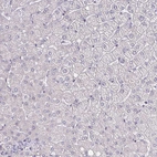 Immunohistochemical staining of human liver shows no positivity in hepatocytes as expected.