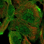 Immunofluorescent staining of human cell line HaCaT shows localization to nucleoplasm & plasma membrane.