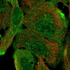 Immunofluorescent staining of human cell line HaCaT shows localization to nucleoplasm & plasma membrane.
