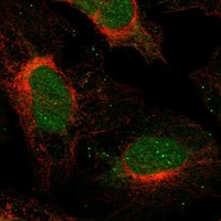 Anti-SFMBT2 Antibody