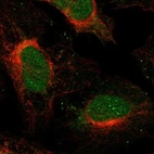 Anti-SFMBT2 Antibody