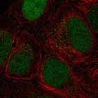Anti-CTDP1 Antibody
