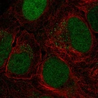 Anti-CTDP1 Antibody