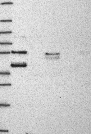Anti-HSPBP1 Antibody