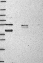 Anti-HSPBP1 Antibody