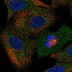 Immunofluorescent staining of human cell line A549 shows localization to cytosol & centrosome.
