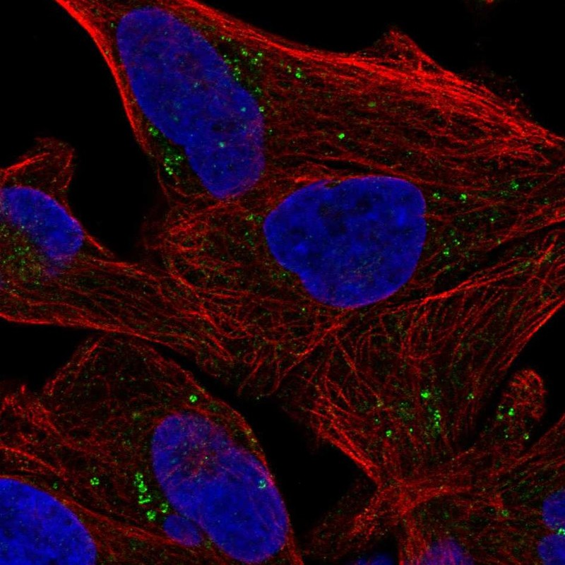 Anti-SEPSECS Antibody
