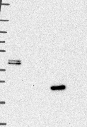 Anti-CTSL Antibody