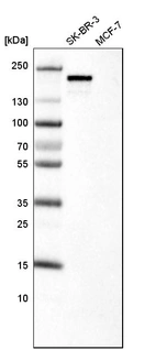Western blot analysis in human cell line SK-BR-3 and human cell line MCF-7.