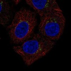 Immunofluorescent staining of human cell line A549 shows localization to the Golgi apparatus & vesicles.